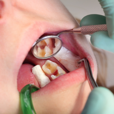 Tecnología dental avanzada