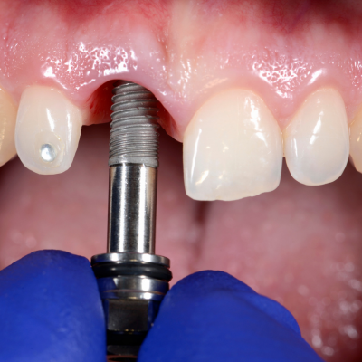 Resultados exitosos OdontoEden